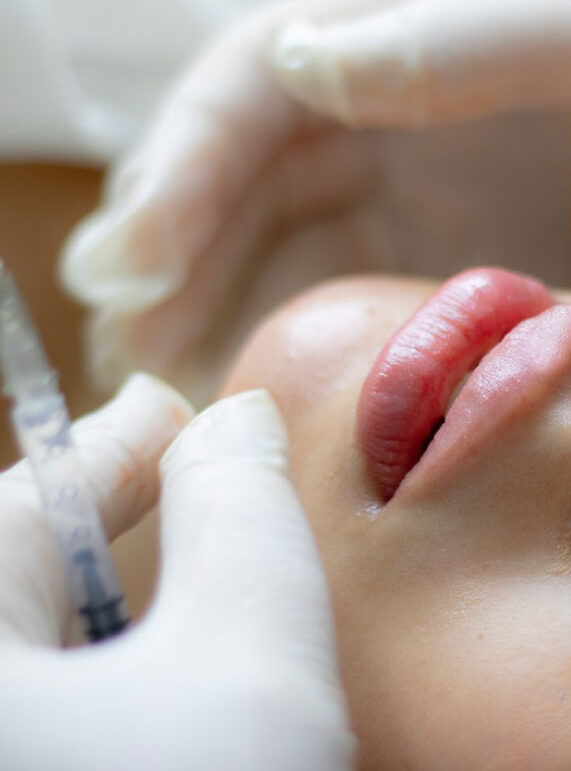 Dermal Fillers